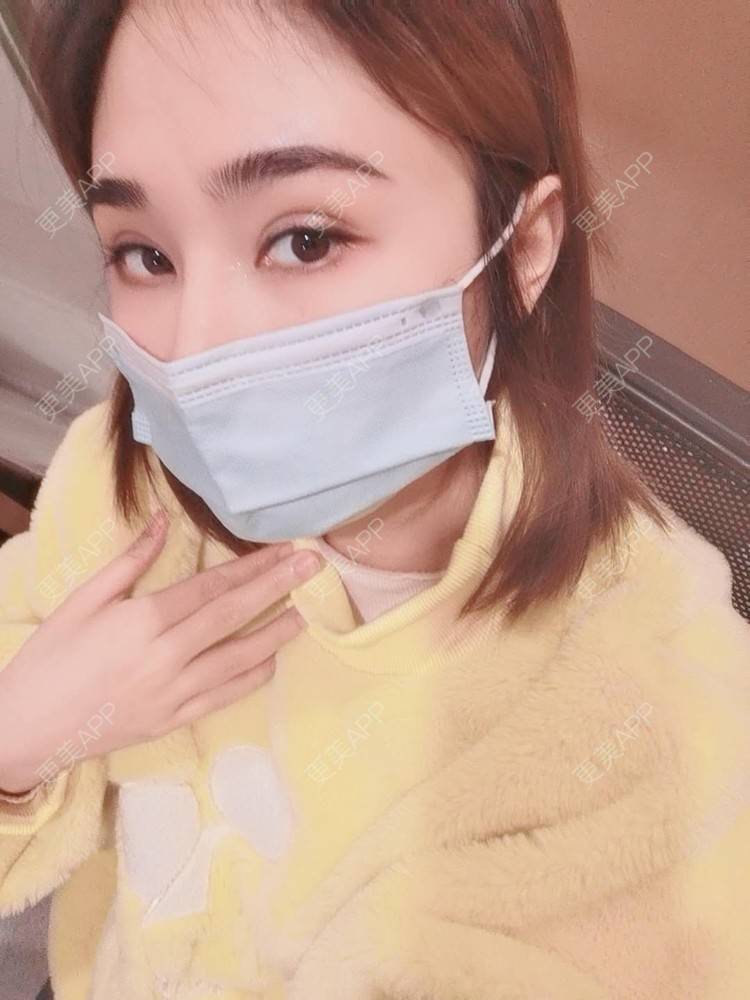 更美 - 小熊饼最爱的双眼皮修复经验 | 重庆 | 双眼皮修复