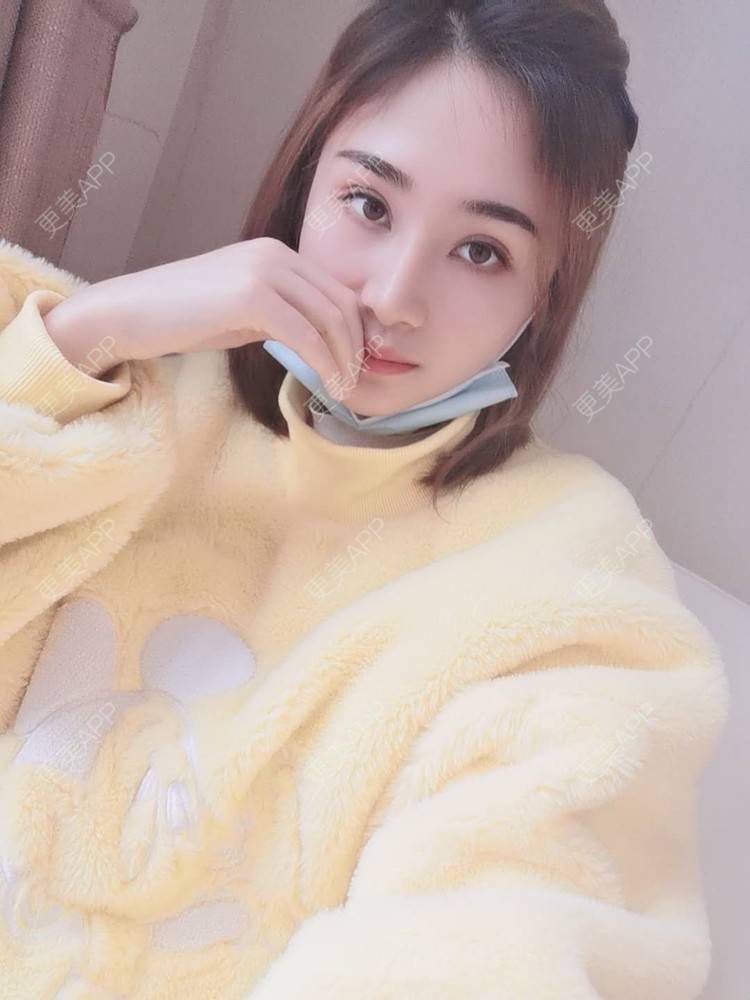 更美 - 小熊饼最爱的双眼皮修复经验 | 重庆 | 双眼皮修复