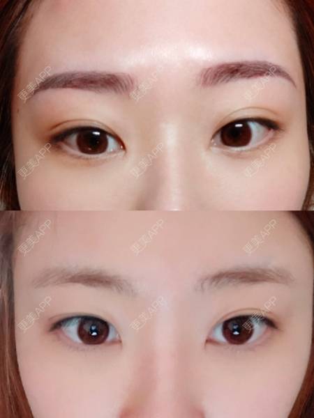 更美 - 更美用户Rk9gy8wDeO的半永久纹眉经验 | 上海 | 半永久纹眉