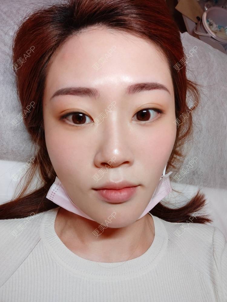 更美 - 更美用户Rk9gy8wDeO的半永久纹眉经验 | 上海 | 半永久纹眉