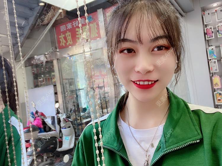 更美 - 更美用户nh0OukLNMd的牙齿矫正经验 | 牙齿矫正 | 成都