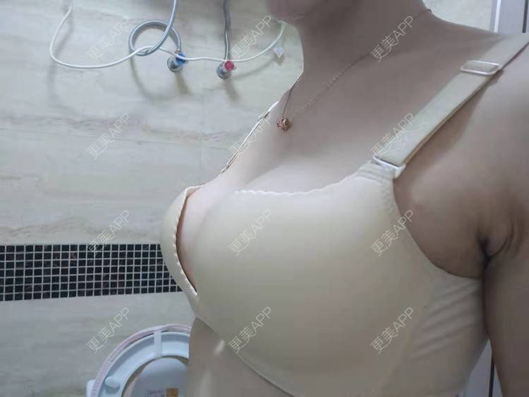 更美 - 辣辣的辣辣的假体隆胸经验 | 视频日记 | 杭州 | 假体隆胸 | 更美研究所