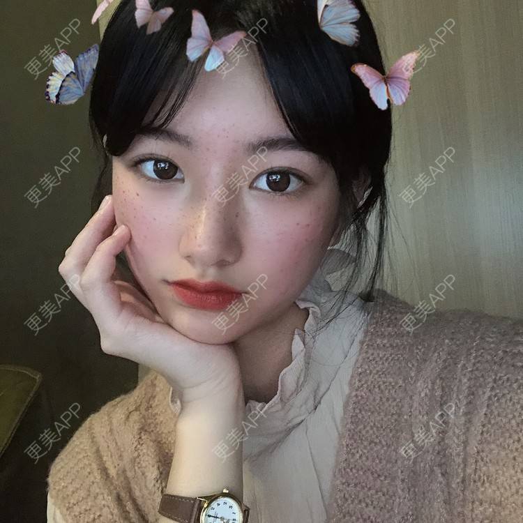 更美 - 很怀恋我俩的爱情戏的自体脂肪填充泪沟经验 | 自体脂肪填充泪沟 | 自体脂肪丰苹果肌 | 自体脂肪垫下巴 | 自体脂肪丰面颊 | 自体脂肪丰太阳穴 | 台州