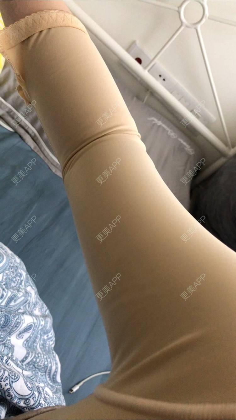 更美 - 幼熙baby的吸脂去副乳经验 | 吸脂去副乳 | 深圳