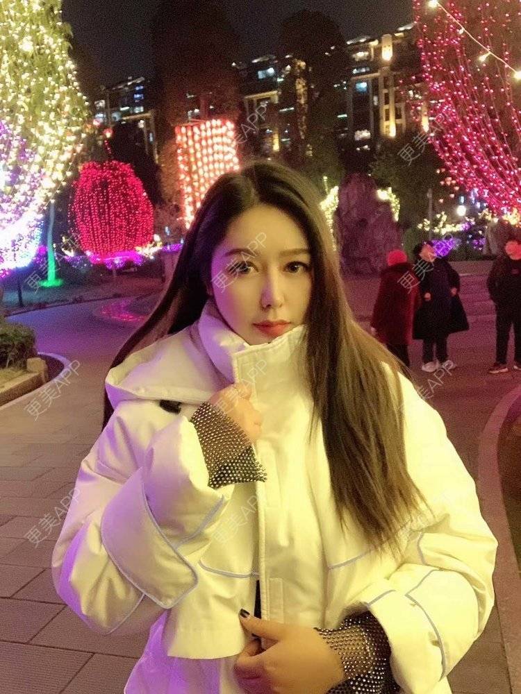 更美 - 更美用户dapPewZ45A的自体脂肪丰额头经验 | 视频日记 | 自体脂肪丰额头 | 重庆