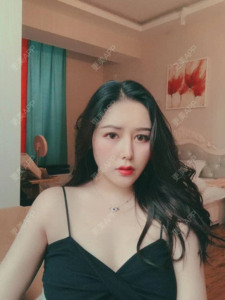 更美 - 更美用户dapPewZ45A的自体脂肪丰额头经验 | 视频日记 | 自体脂肪丰额头 | 重庆