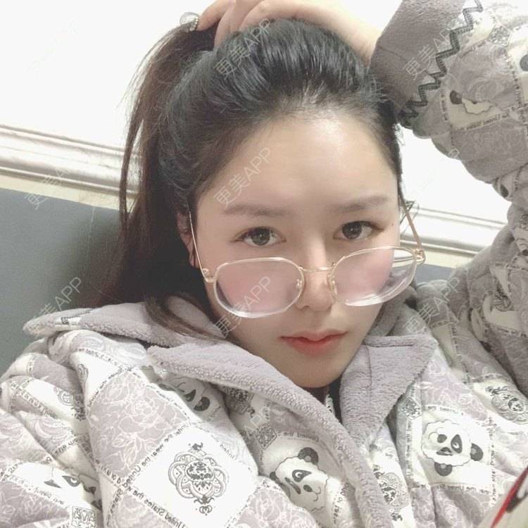 更美 - 更美用户dapPewZ45A的自体脂肪丰额头经验 | 视频日记 | 自体脂肪丰额头 | 重庆