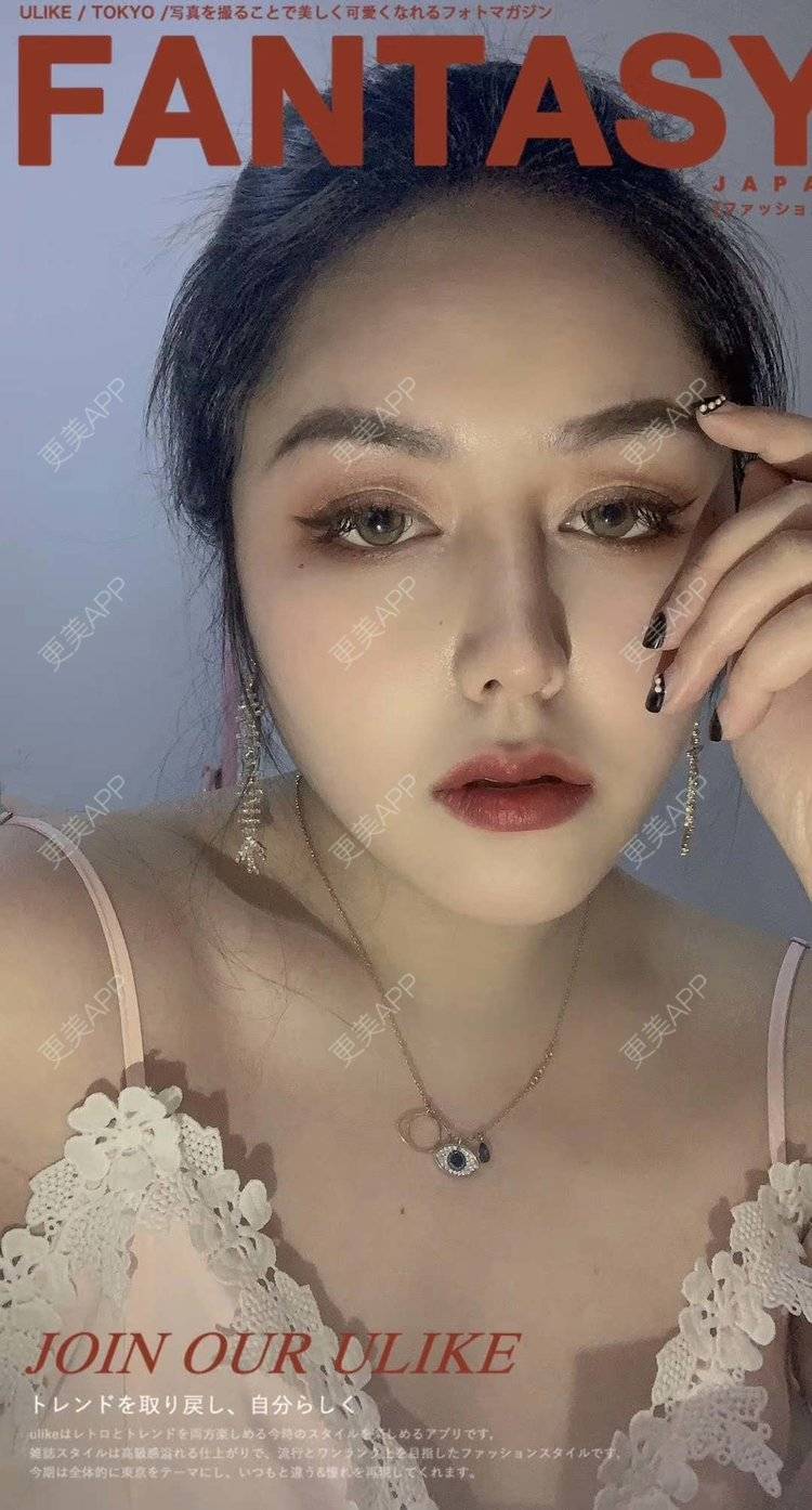 更美 - 更美用户dapPewZ45A的自体脂肪丰额头经验 | 视频日记 | 自体脂肪丰额头 | 重庆