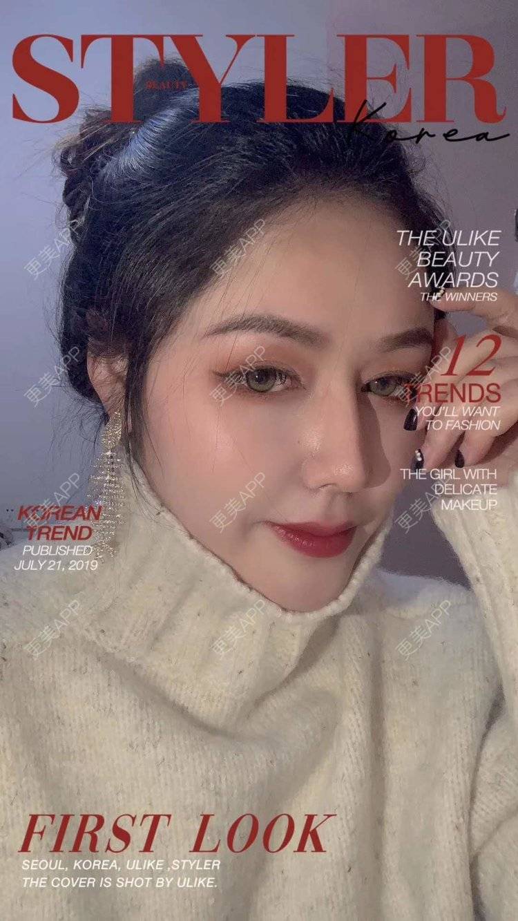 更美 - 更美用户dapPewZ45A的自体脂肪丰额头经验 | 视频日记 | 自体脂肪丰额头 | 重庆