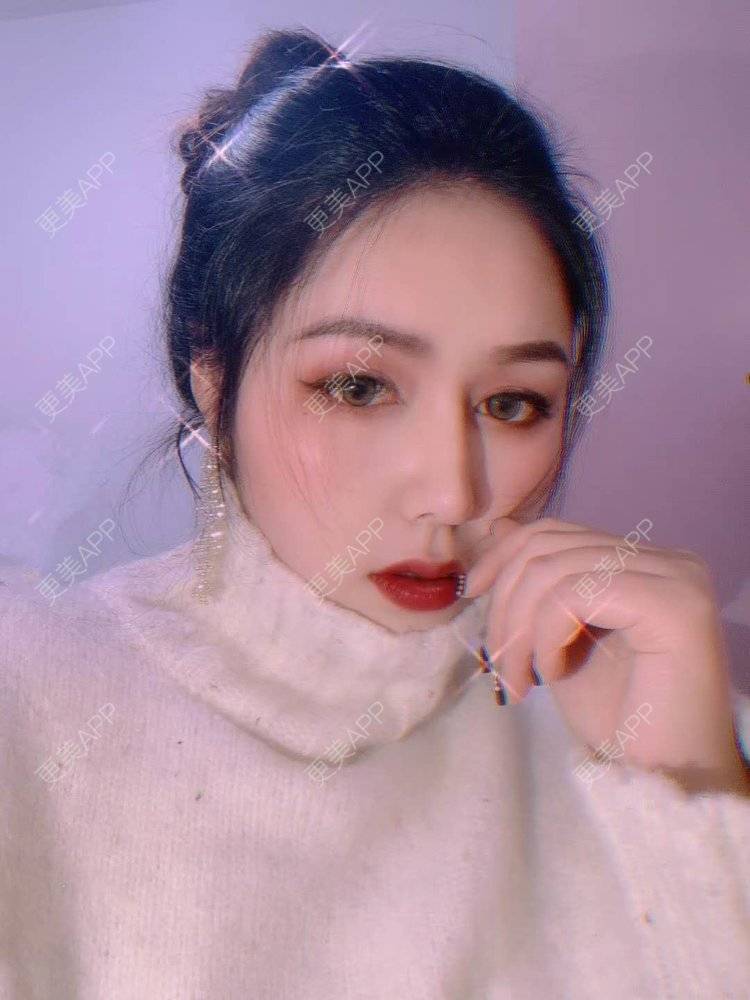 更美 - 更美用户dapPewZ45A的自体脂肪丰额头经验 | 视频日记 | 自体脂肪丰额头 | 重庆