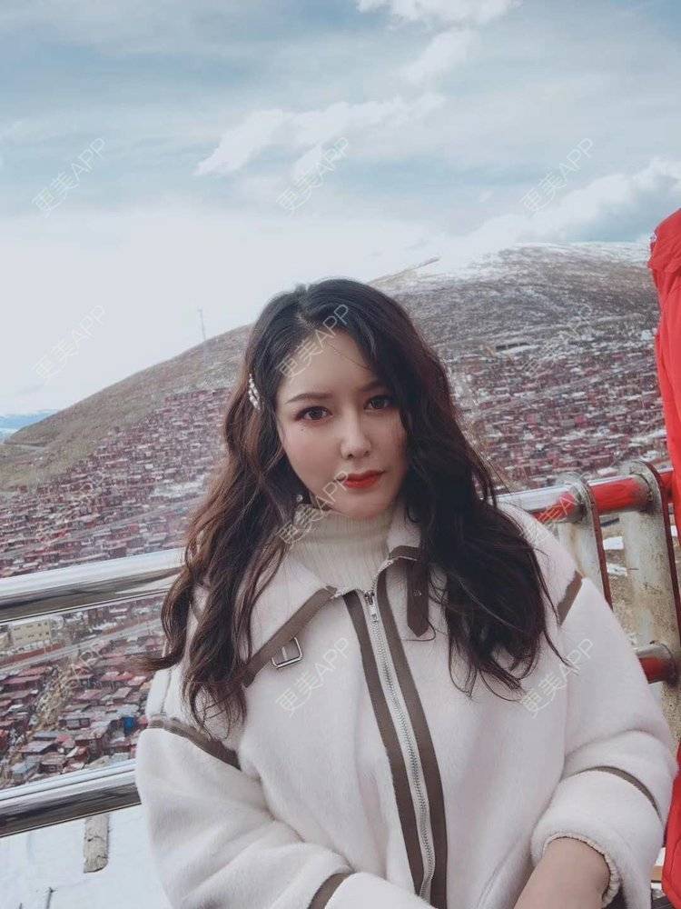 更美 - 更美用户dapPewZ45A的自体脂肪丰额头经验 | 视频日记 | 自体脂肪丰额头 | 重庆