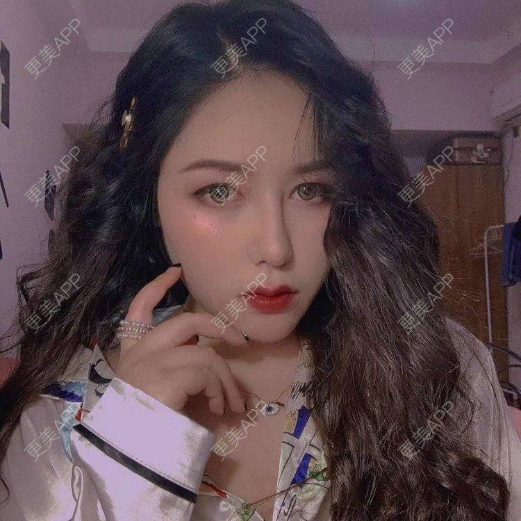 更美 - 更美用户dapPewZ45A的自体脂肪丰额头经验 | 视频日记 | 自体脂肪丰额头 | 重庆