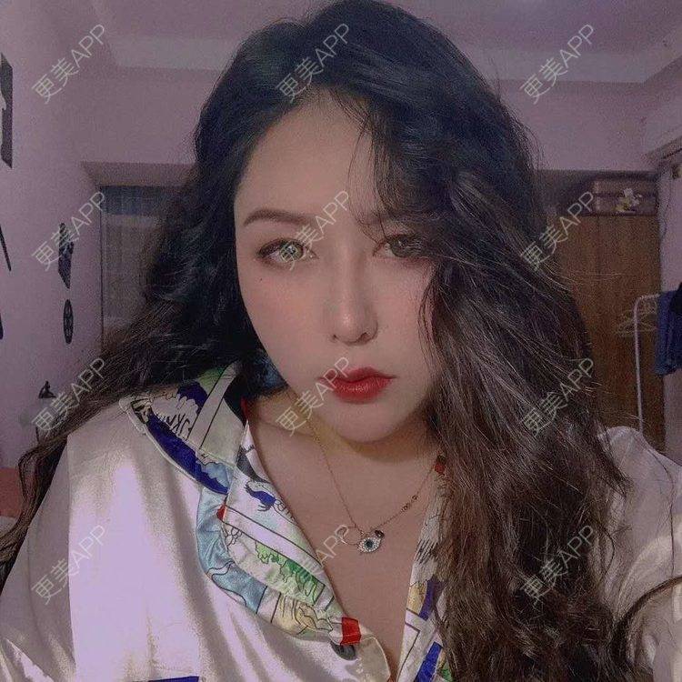 更美 - 更美用户dapPewZ45A的自体脂肪丰额头经验 | 视频日记 | 自体脂肪丰额头 | 重庆