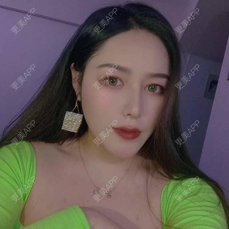 更美 - 更美用户dapPewZ45A的自体脂肪丰额头经验 | 视频日记 | 自体脂肪丰额头 | 重庆