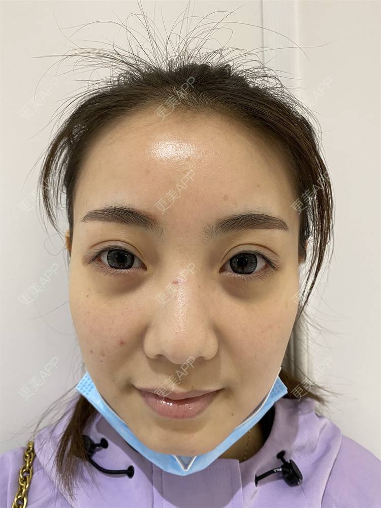 更美 - ⌒安穩過現實衫的胶原蛋白淡化黑眼圈经验 | 胶原蛋白淡化黑眼圈 | 杭州