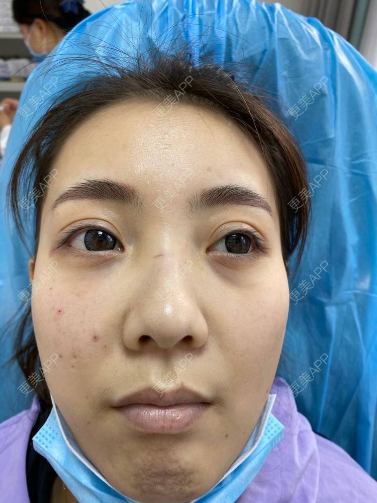 更美 - ⌒安穩過現實衫的胶原蛋白淡化黑眼圈经验 | 胶原蛋白淡化黑眼圈 | 杭州