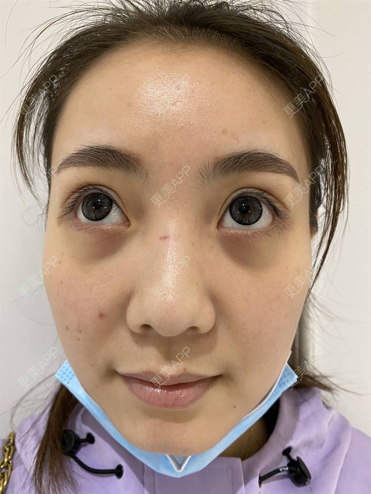 更美 - ⌒安穩過現實衫的胶原蛋白淡化黑眼圈经验 | 胶原蛋白淡化黑眼圈 | 杭州