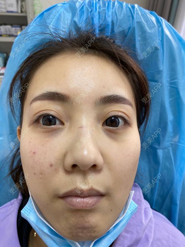 更美 - ⌒安穩過現實衫的胶原蛋白淡化黑眼圈经验 | 胶原蛋白淡化黑眼圈 | 杭州