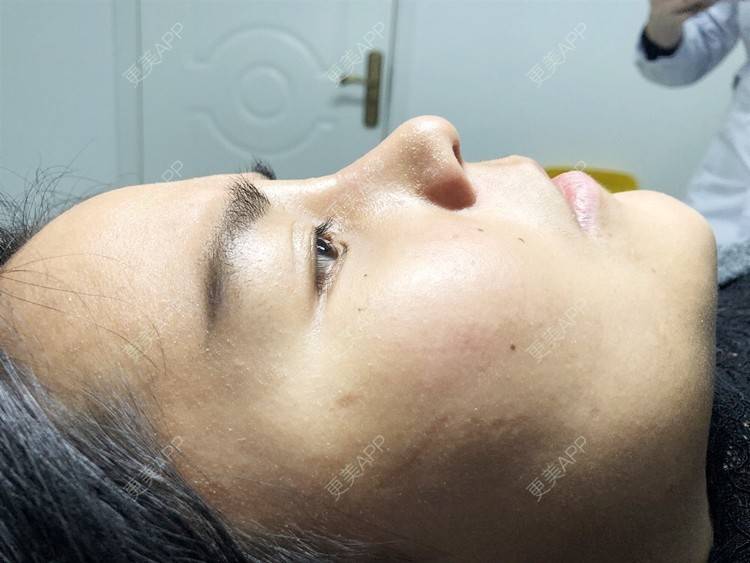 更美 - 更美用户zwQN5e8jIh的鼻部多项经验 | 鼻部多项 | 长沙