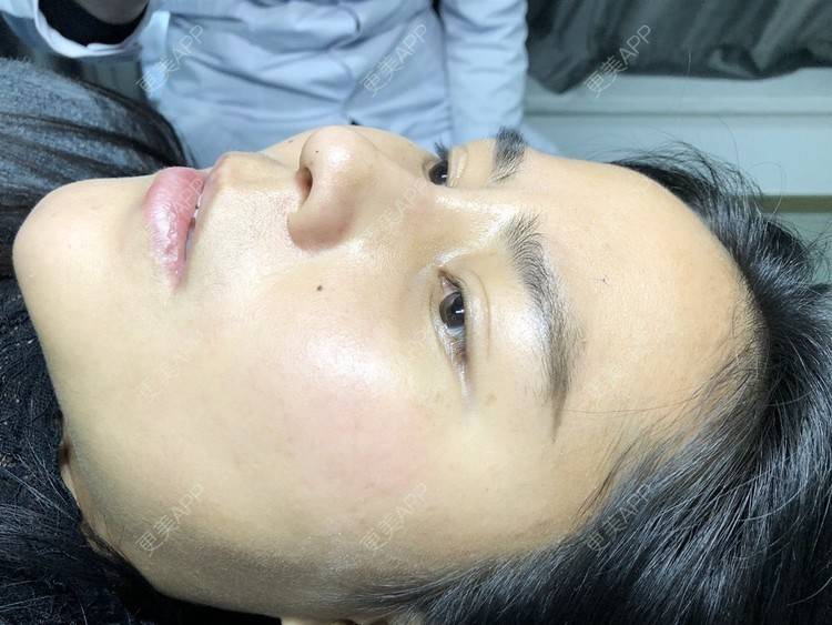 更美 - 更美用户zwQN5e8jIh的鼻部多项经验 | 鼻部多项 | 长沙