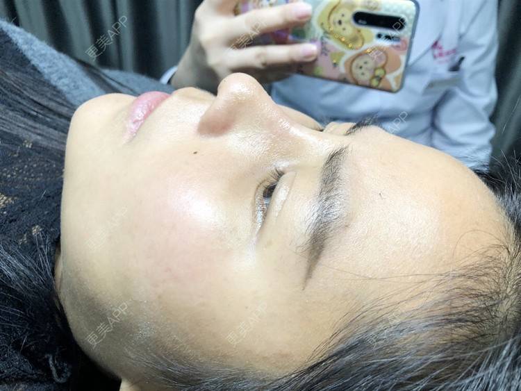 更美 - 更美用户zwQN5e8jIh的鼻部多项经验 | 鼻部多项 | 长沙