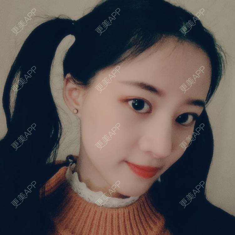 更美 - 蔓蔓不慢哦的全切双眼皮经验 | 全切双眼皮 | 眼皮下垂矫正 | 重庆 | 双眼皮修复 | 上眼睑去脂 | 眼部多项 | 开眼角修复 | 提眉修复