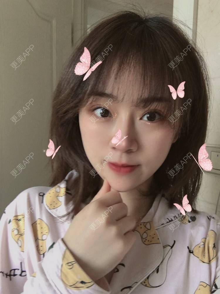 更美 - 小毛毛的夏天的全切双眼皮经验 | 视频日记 | 全切双眼皮 | 宜昌