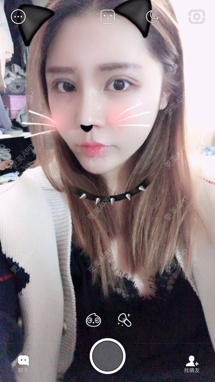 更美 - 更美用户psx6LnSZEo的点阵激光经验 | 成都 | 彩光嫩肤 | 点阵激光 | 超声提升 | 除皱瘦脸