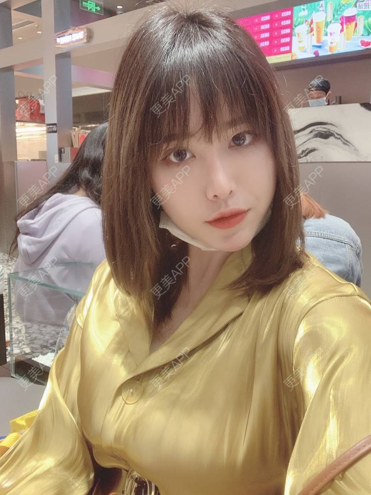 更美 - 未来食神的全切双眼皮经验 | 全切双眼皮 | 开内眼角 | 眼皮下垂矫正 | 重庆 | 双眼皮修复 | 眼部多项 | 开眼角修复