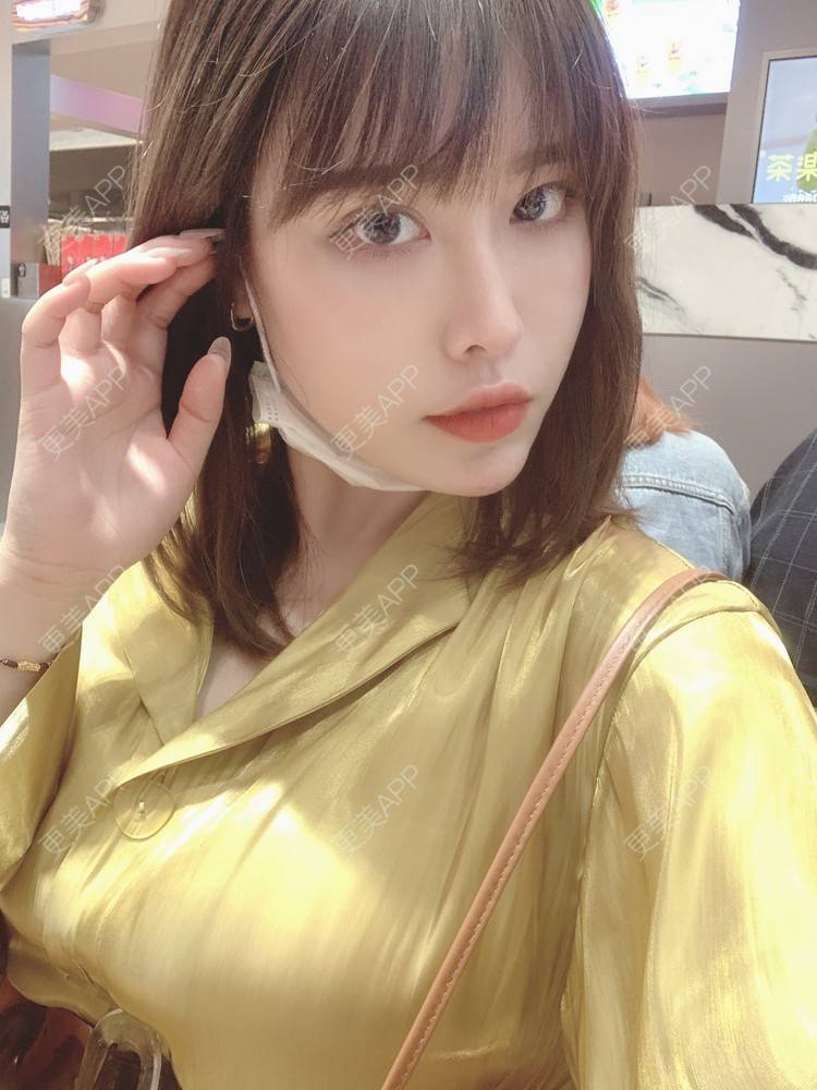 更美 - 未来食神的全切双眼皮经验 | 全切双眼皮 | 开内眼角 | 眼皮下垂矫正 | 重庆 | 双眼皮修复 | 眼部多项 | 开眼角修复