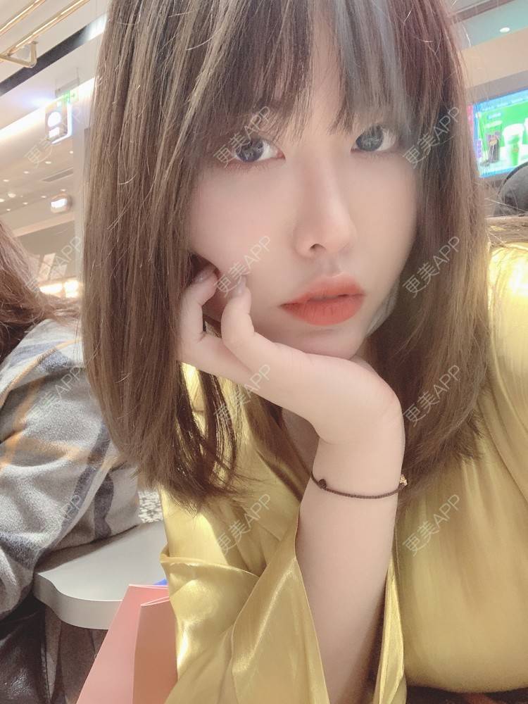 更美 - 未来食神的全切双眼皮经验 | 全切双眼皮 | 开内眼角 | 眼皮下垂矫正 | 重庆 | 双眼皮修复 | 眼部多项 | 开眼角修复