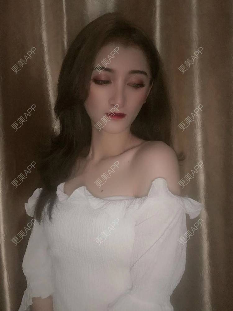 更美 - 最美的期待i的鼻形态修复经验 | 广州 | 鼻形态修复