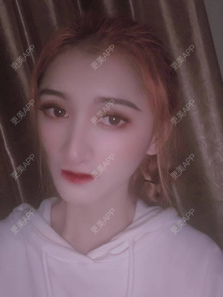 更美 - 最美的期待i的鼻形态修复经验 | 广州 | 鼻形态修复