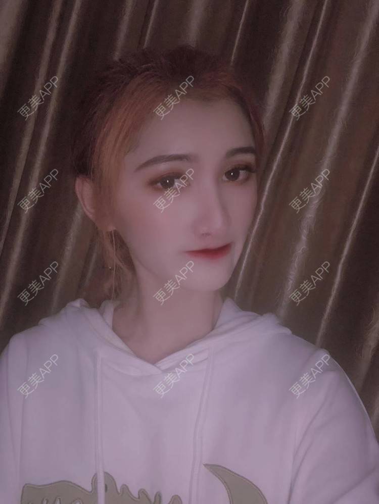 更美 - 最美的期待i的鼻形态修复经验 | 广州 | 鼻形态修复