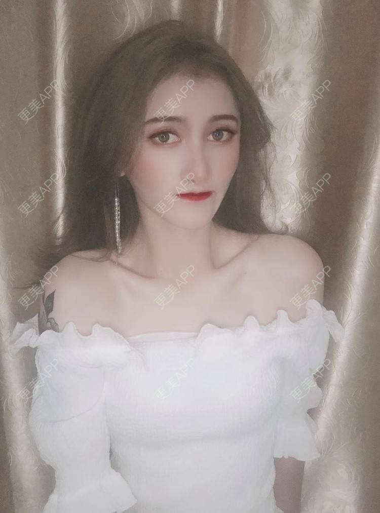 更美 - 最美的期待i的鼻形态修复经验 | 广州 | 鼻形态修复