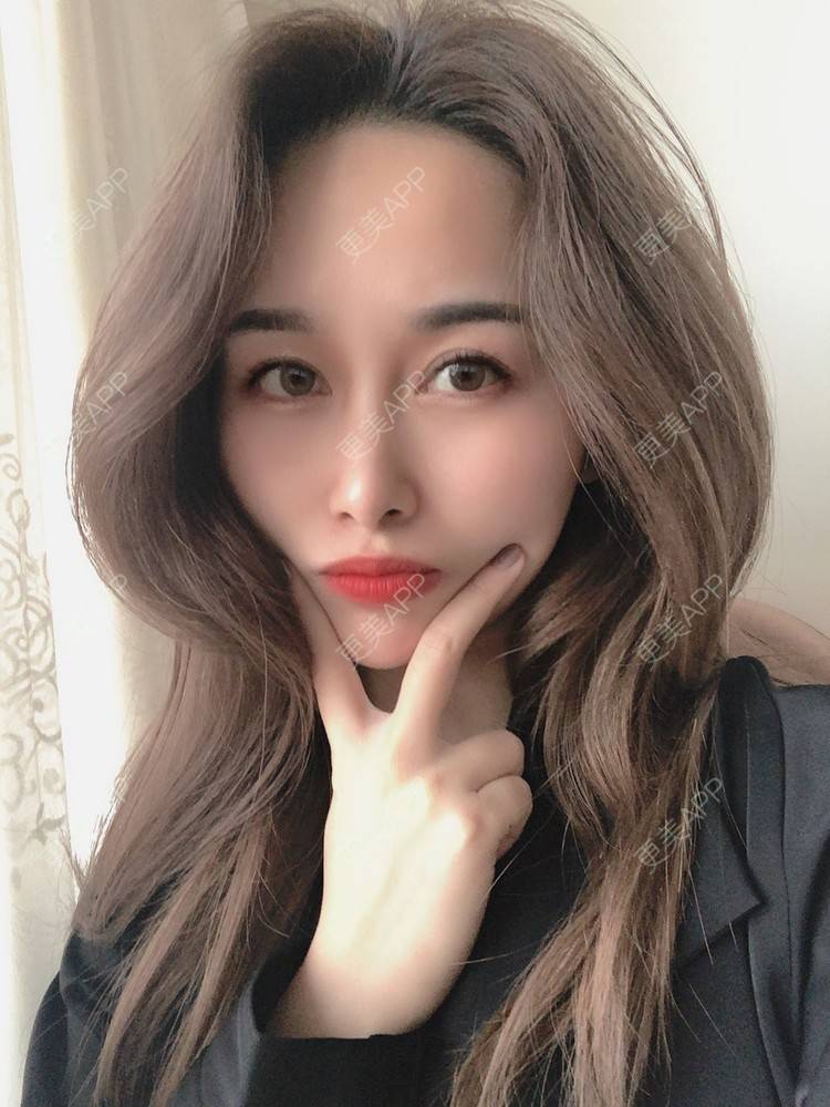 更美 - 甜心泡芙的双眼皮修复经验 | 双眼皮 | 全切双眼皮 | 开内眼角 | 重庆 | 双眼皮修复