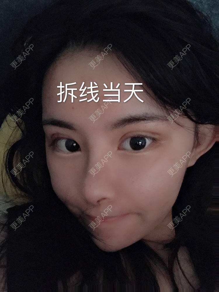 更美 - 长沙市希美医疗美容的鼻部多项经验 | 鼻部多项 | 长沙