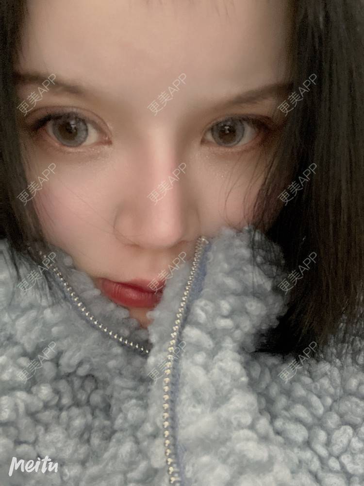 更美 - 更美用户qPl9XqbpZ9的洗眼线经验 | 激光洗纹身 | 郑州 | 洗眼线