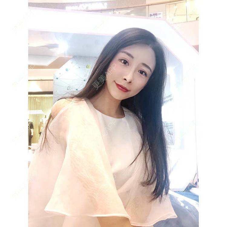 更美 - 兰质慧心的自体脂肪丰苹果肌经验 | 视频日记 | 自体脂肪丰面颊 | 上海 | 自体脂肪丰苹果肌 | 自体脂肪垫下巴
