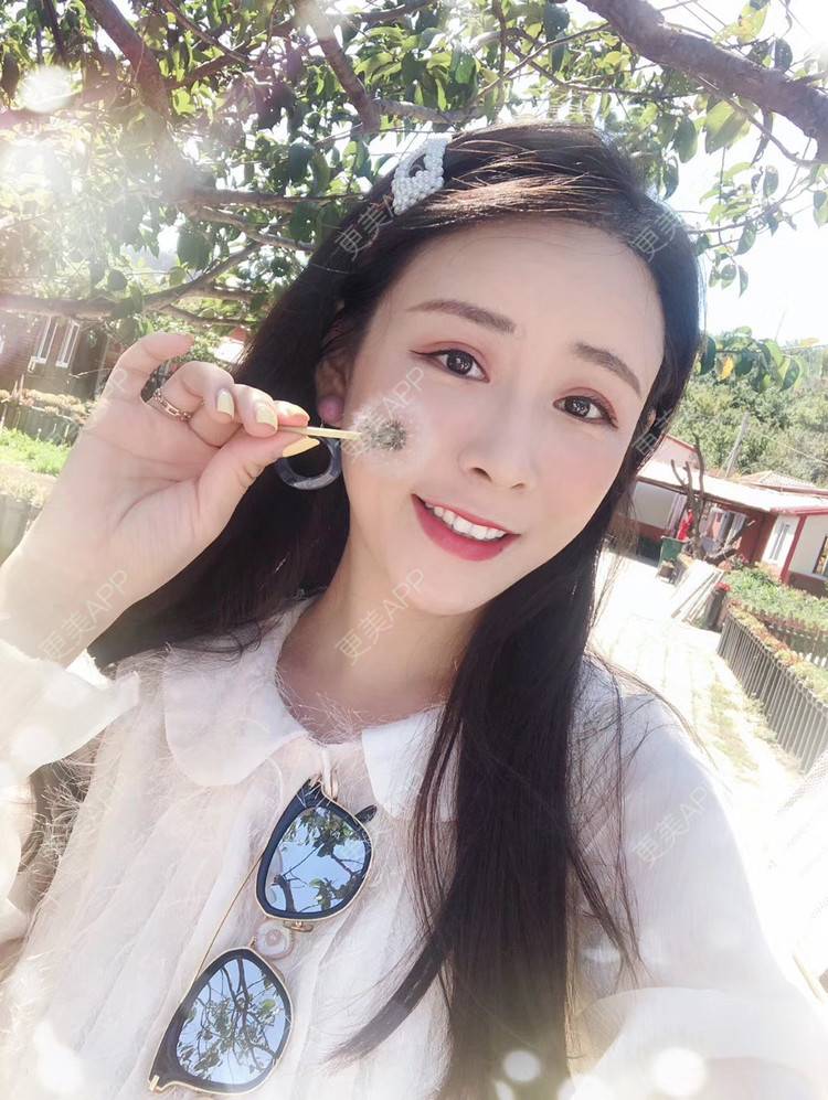 更美 - 兰质慧心的自体脂肪丰苹果肌经验 | 视频日记 | 自体脂肪丰面颊 | 上海 | 自体脂肪丰苹果肌 | 自体脂肪垫下巴