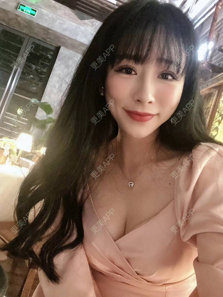 更美 - 兰质慧心的自体脂肪丰苹果肌经验 | 视频日记 | 自体脂肪丰面颊 | 上海 | 自体脂肪丰苹果肌 | 自体脂肪垫下巴