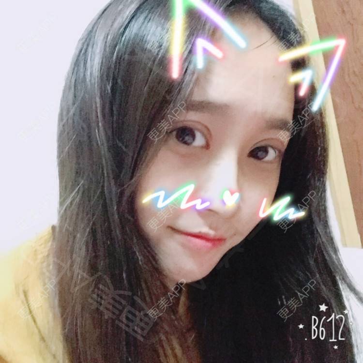 更美 - 半夏0的双眼皮经验 | 双眼皮 | 更美研究所 | 大腿脱毛 | 成都 | 视频日记