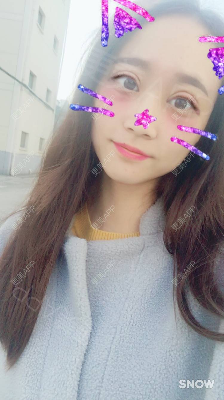 更美 - 半夏0的双眼皮经验 | 双眼皮 | 更美研究所 | 大腿脱毛 | 成都 | 视频日记