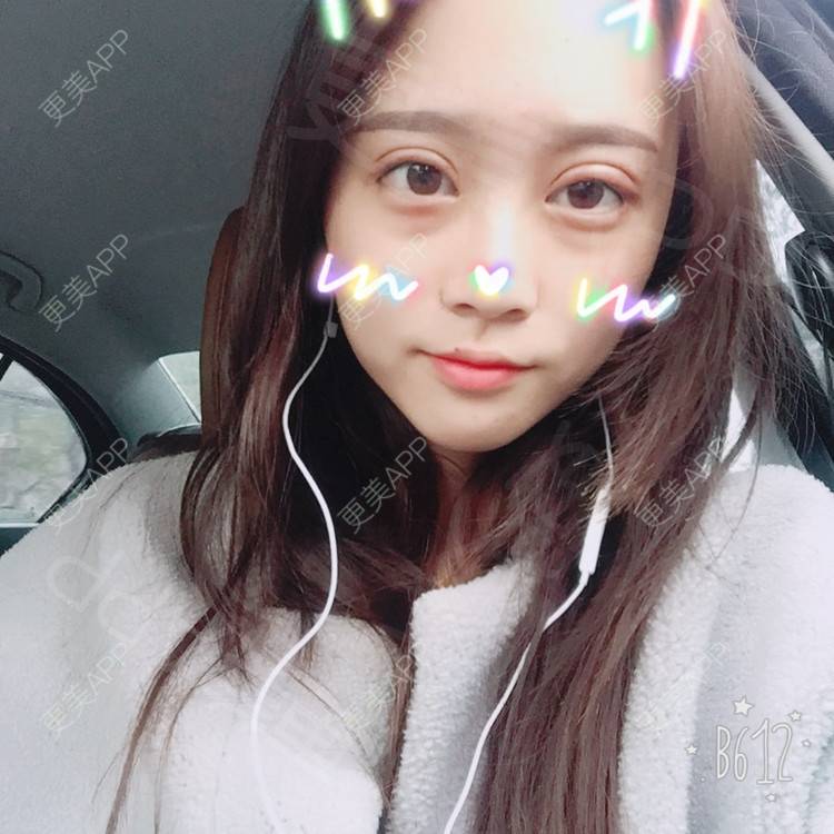 更美 - 半夏0的双眼皮经验 | 双眼皮 | 更美研究所 | 大腿脱毛 | 成都 | 视频日记