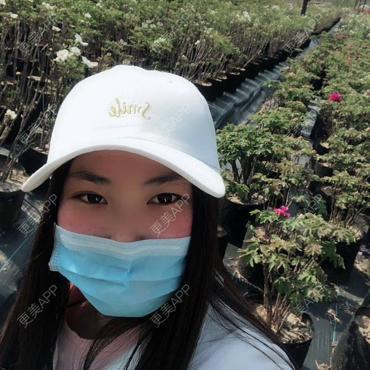 更美 - 水依人的皮秒激光经验 | 视频日记 | 上海 | 皮秒激光