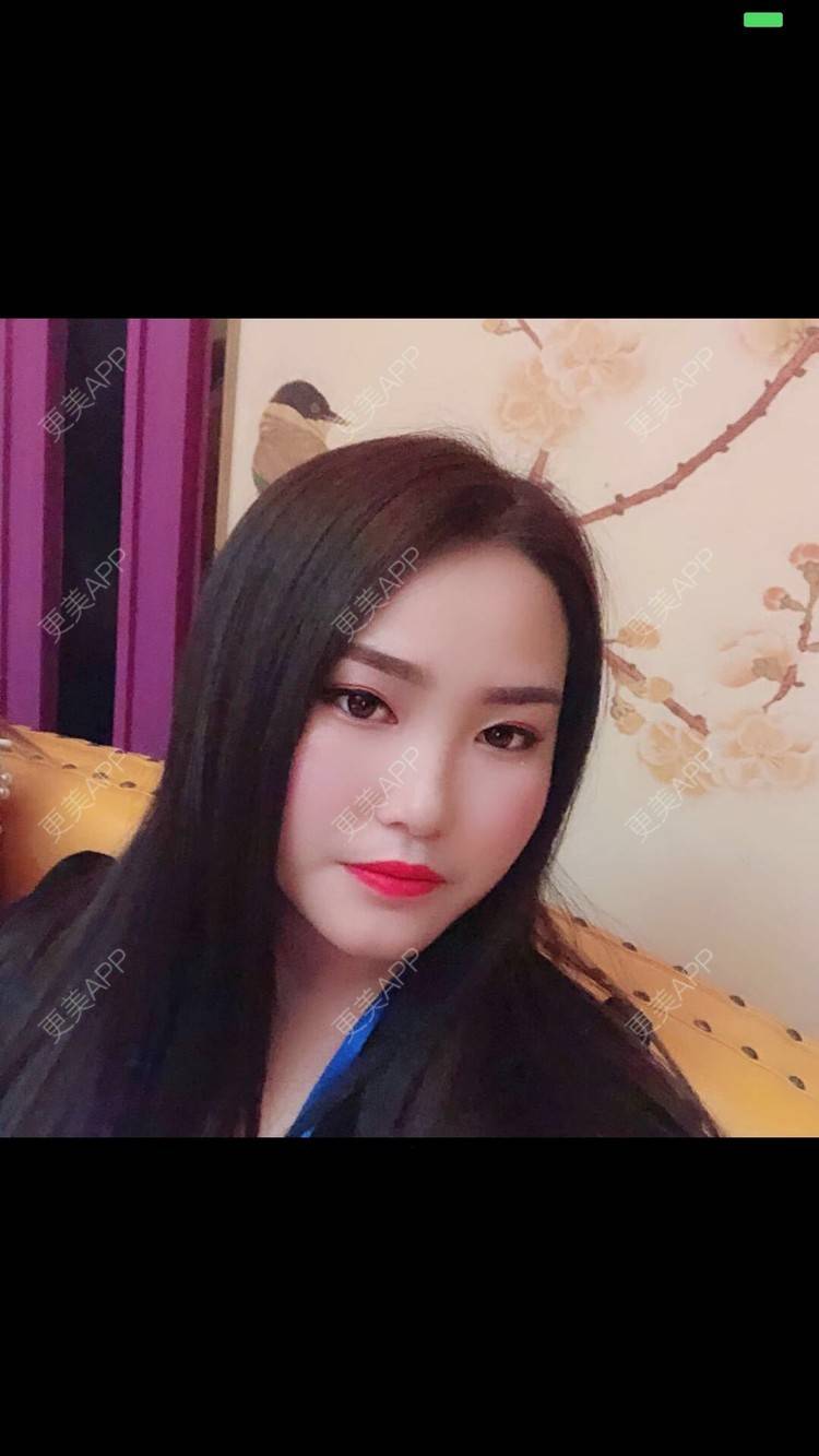 更美 - 水依人的皮秒激光经验 | 上海 | 皮秒激光