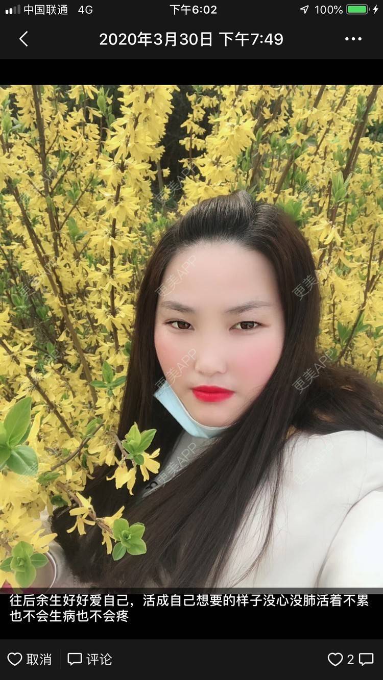 更美 - 水依人的皮秒激光经验 | 上海 | 皮秒激光