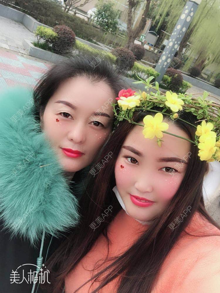 更美 - 水依人的皮秒激光经验 | 上海 | 皮秒激光