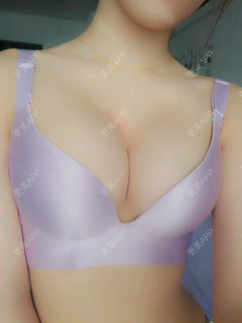 更美 - 更美用户2o60cQKUEs的假体隆胸经验 | 假体隆胸 | 乳头再造 | 美胸套餐 | 重庆