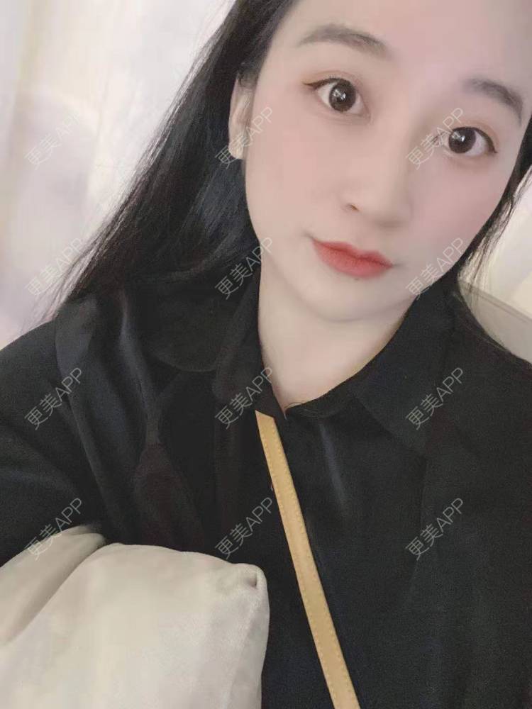 更美 - 更美用户129LF9Yh6a的玻尿酸下巴经验 | 视频日记 | 玻尿酸下巴 | 广州